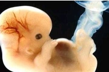 孕期11周6天的胎儿图片