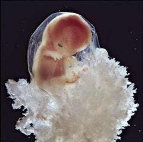 胚胎停止发育原因