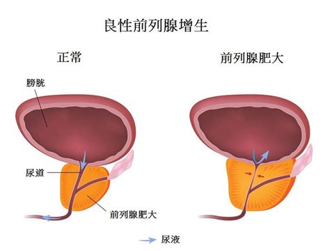 男性滋阴的最佳方法