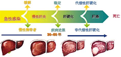 奇人专治乙肝