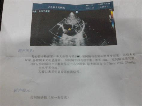 房缺能活到80岁吗
