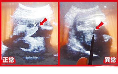 8周胎儿正常大小