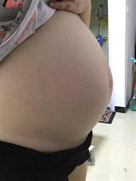 孕妇肚子中间黑线看男女