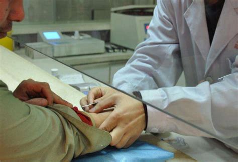 免疫不孕怎么治疗好