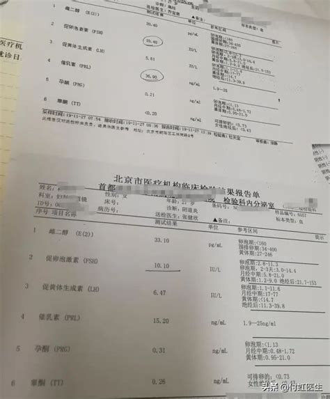 男性促卵泡刺激素多少正常