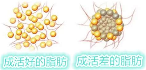 腿部溶脂针打了3瓶.不打了多久会排出体外