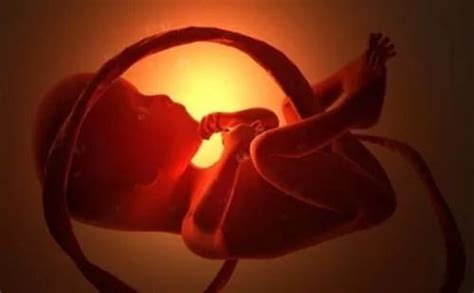 胎儿宫内缺氧胎心率会正常吗