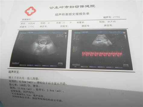 怀孕5周未见胚芽及原始心管搏动