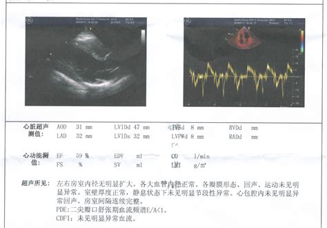 做了四维医生建议做心脏彩超
