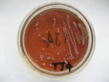 罗伊氏乳杆菌非活菌型
