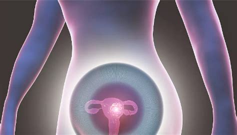 子宫内膜异位症必须做试管吗
