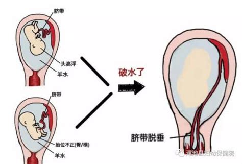 孕期常见症状及处理课程总结