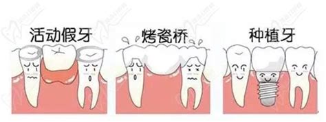 老年人整口假牙多少钱