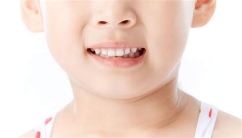 遗传性的牙病怎么预防好