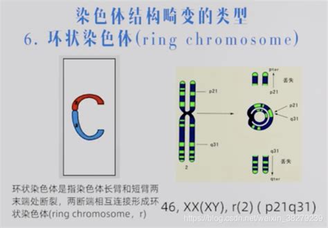 染色体筛查收费标准