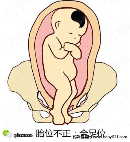 孕37周正常胎位图