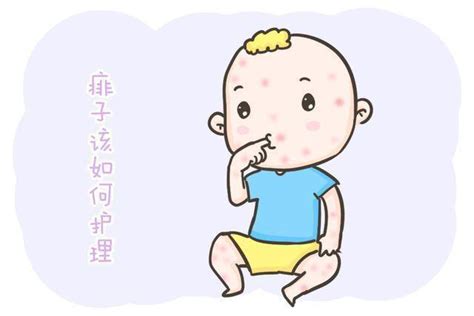 起痱子不能用痱子粉吗