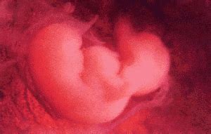 6个月胎儿真实图片