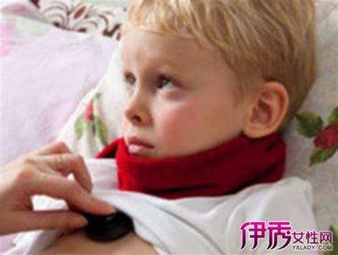 孩子重感冒的症状