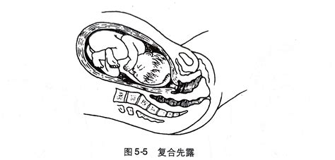 孕妇可以刮痧哪个部位