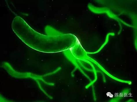 幽门螺旋杆菌会癌变吗?