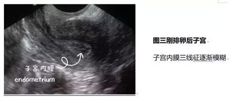 两个月来一次月经能怀孕吗