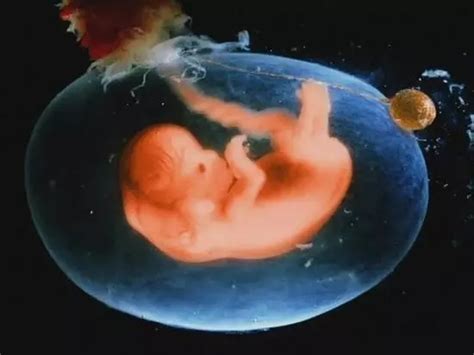 引产4个多月的胎儿能活吗