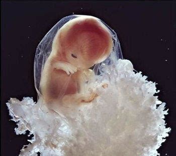 2次胎停胚胎染色体异常