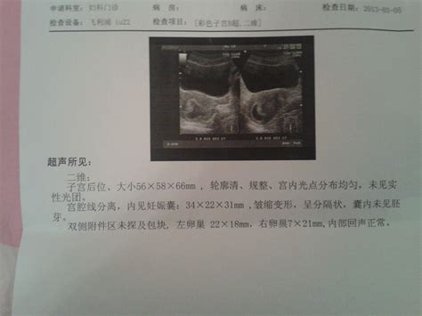 怀孕应该是40周还是42周