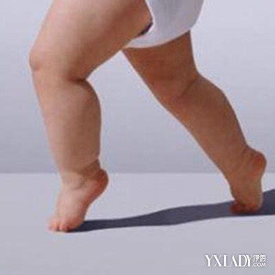 32周男宝宝腿短
