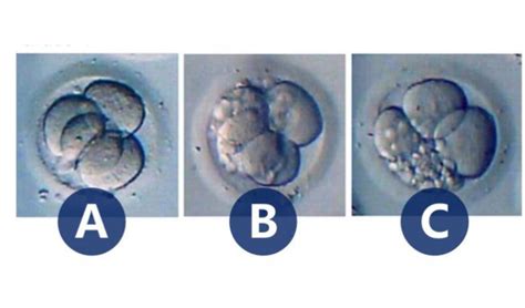 囊胚移植8天hcg49.5