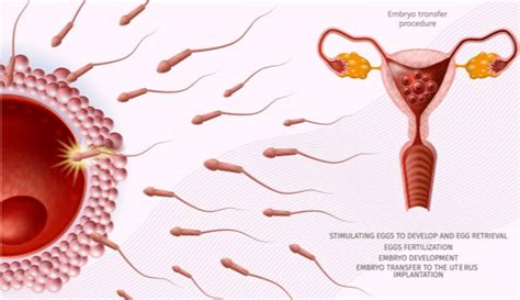 宫缩与胎动的区别