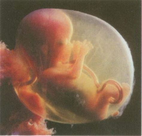 怀孕38周羊水偏多对胎儿有影响吗