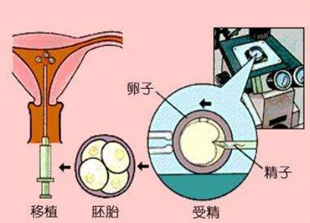 泰国试管有个什么平台