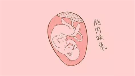 胎心和宫缩怎么看