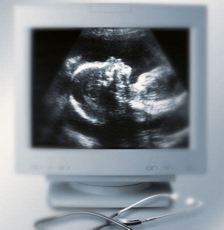 B超检查对胎儿有影响吗?