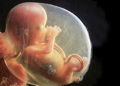胎儿32周能做引产吗