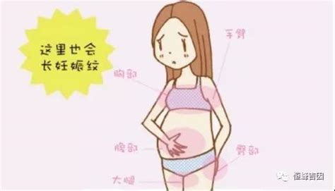 孕期脐带扭转怎么预防