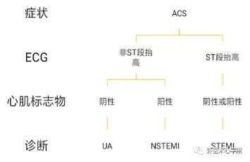 女性胸部左上方疼痛是怎么回事