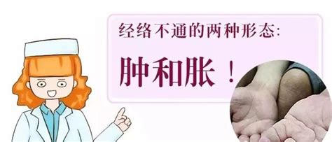 臀部经络淤堵的症状