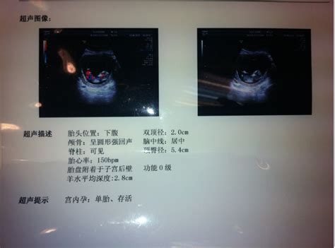 怀孕去医院做b超挂什么科