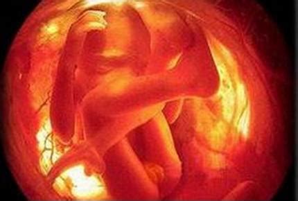 24周胎儿四维彩超图