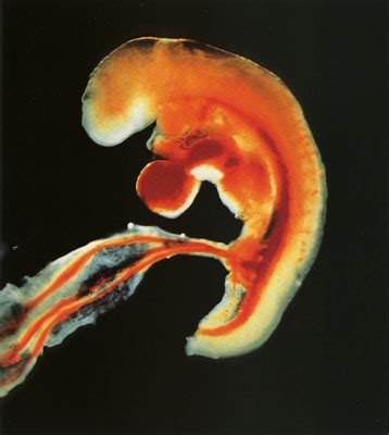 6周的胎儿有多大图片