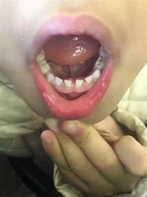 孩子第一次掉牙的说说【共计67段】