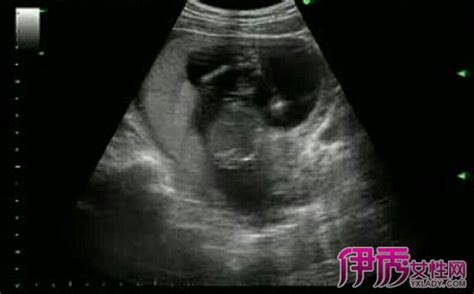 怀孕12周胎儿动态图