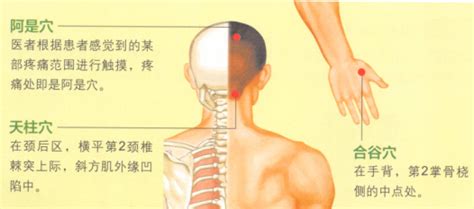 偏头疼刮痧刮哪个部位