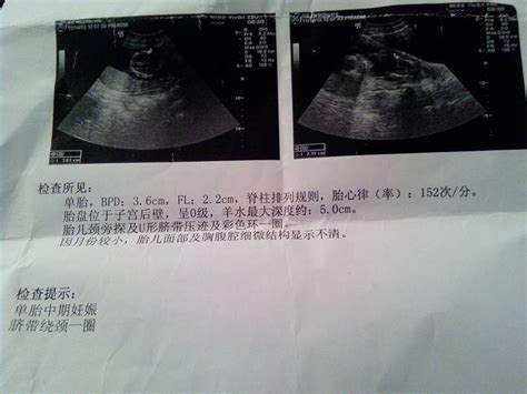 怀孕14周胎儿面部图片