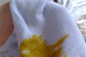 宝宝大便带血的5种可能