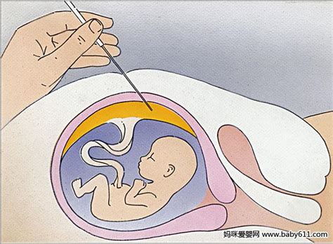 备孕期间怎样才能优生