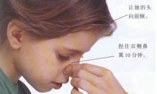 小孩鼻炎流脓鼻涕怎么治疗